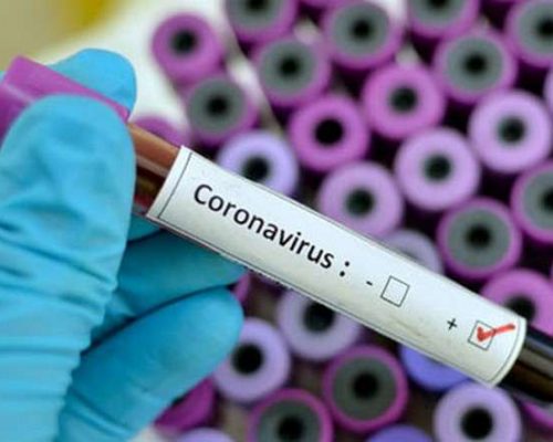 На Житомирщині за добу збільшилась кількість хворих – 33 нові випадки COVID-19, з них 3 у Житомирському районі