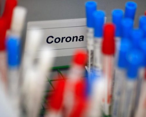 В Україні за добу зафіксовано 829 нових випадків коронавірусної хвороби COVID-19