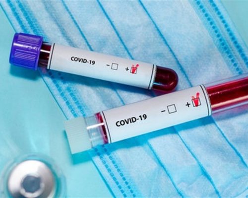 COVID-19 на Житомирщині: зафіксовано 18 нових випадків захворювання, з них 5 у Житомирському районі