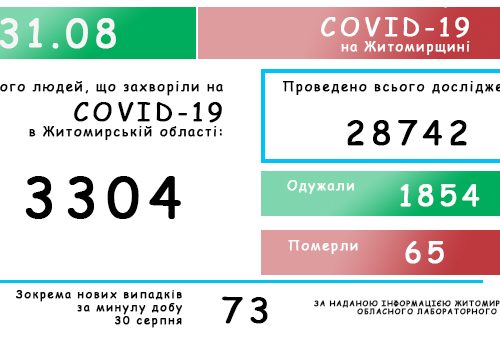 Обласний лабораторний центр повідомляє: на Житомирщині зафіксовано 3304 випадки коронавірусної хвороби COVID-19